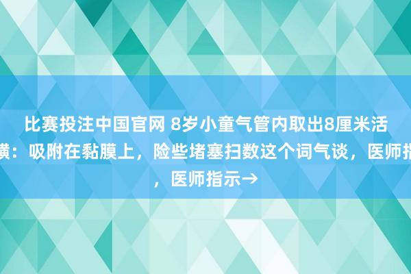 比赛投注中国官网 8岁小童气管内取出8厘米活体蚂蟥：吸附在黏膜上，险些堵塞扫数这个词气谈，医师指示→